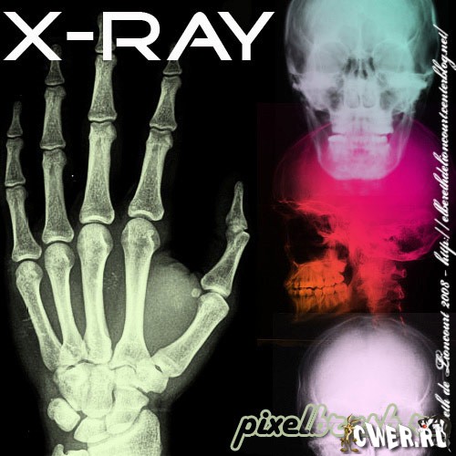 x ray photoshop download