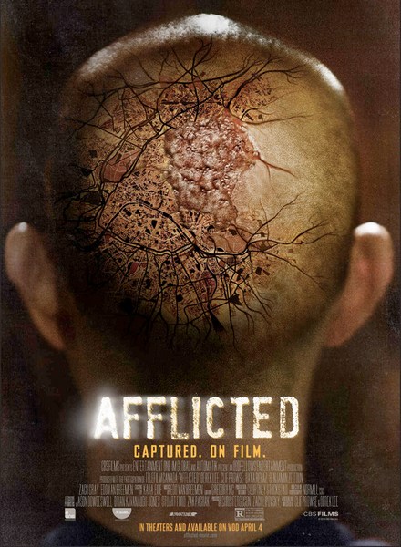 Пораженный / Afflicted (2013) WEBDLRip