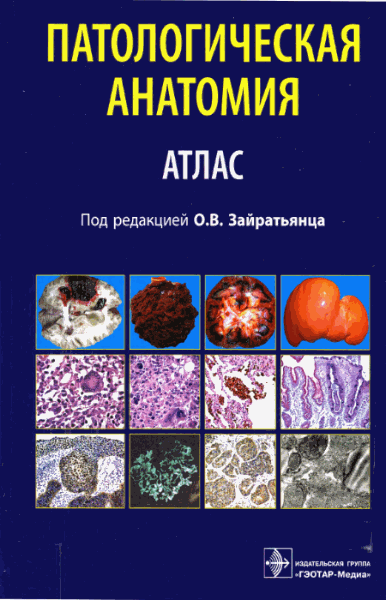 Олег Зайратьянц, Светлана Бойкова. Патологическая анатомия. Атлас