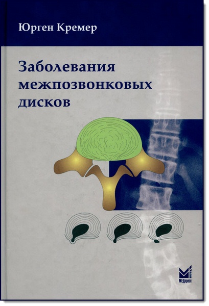 Юрген Кремер. Заболевания межпозвонковых дисков